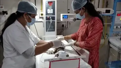 Baby Buried Alive in India Battles for Survival
